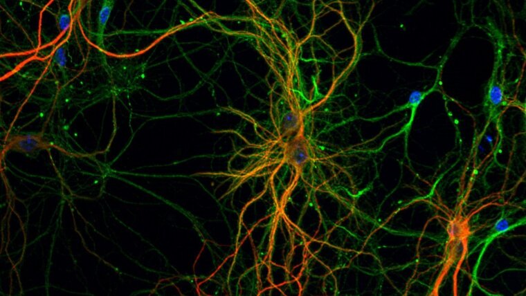 Cultured primary neurons with stained endoplasmic reticulum (green), dendrites (red) and the nucleus (blue).